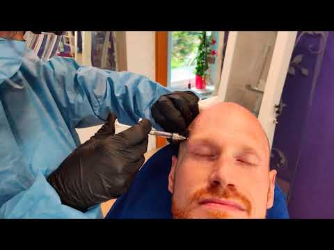 Vorschaubild: Hyaluron Behandlung bei Epicure Köln